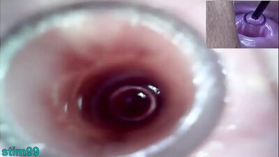 Lesbians Extreme Cervix Play and Peehole Fucking Penis Dildo